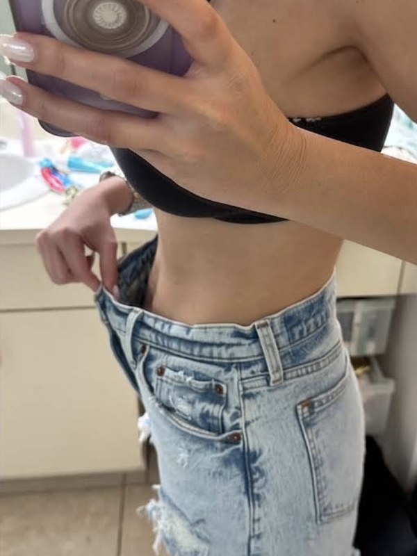 GLP-1 medical weight loss after, patient showing slimmer waistline in loose-fitting denim after six-month program.