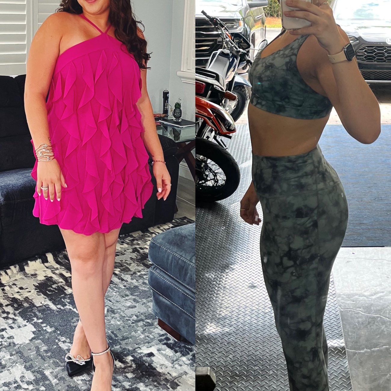 Patient before and after photo at The Aesthetic Ranch in Fort Lauderdale showing visible body composition and confidence change during a medically supervised weight loss program.