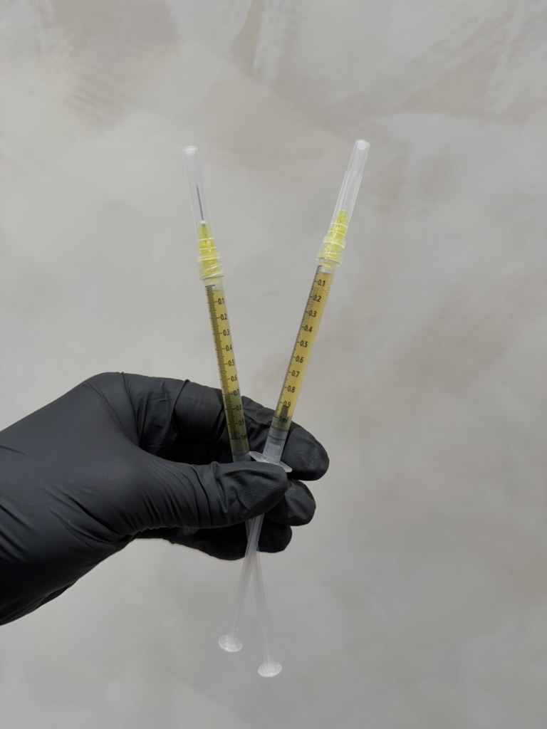 Two PRP syringes filled with golden platelet-rich plasma concentrate held in a black-gloved hand at The Aesthetic Ranch medical spa in downtown Fort Lauderdale, FL, prepared by board-certified Nurse Practitioner Natasha Wilkes for a bio-regenerative treatment.